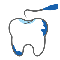 Prevent Gum Disease